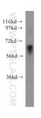 Glypican 3 antibody, 11145-1-AP, Proteintech Group, Western Blot image 