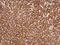 Transketolase antibody, GTX101477, GeneTex, Immunohistochemistry paraffin image 