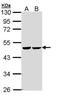 Fumarate Hydratase antibody, PA5-22091, Invitrogen Antibodies, Western Blot image 