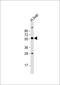 Solute Carrier Family 11 Member 1 antibody, GTX81205, GeneTex, Western Blot image 