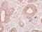 Fibrinogen Gamma Chain antibody, GTX113436, GeneTex, Immunohistochemistry paraffin image 