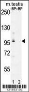 Pyruvate Dehydrogenase Phosphatase Regulatory Subunit antibody, 56-175, ProSci, Western Blot image 