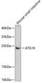 Autophagy Related 10 antibody, GTX55523, GeneTex, Western Blot image 