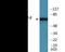 Protein Tyrosine Phosphatase Non-Receptor Type 11 antibody, EKC1957, Boster Biological Technology, Western Blot image 