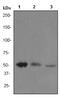Integrin Linked Kinase antibody, ab76468, Abcam, Western Blot image 