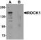 Rho Associated Coiled-Coil Containing Protein Kinase 1 antibody, orb95658, Biorbyt, Western Blot image 