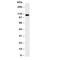 Colony Stimulating Factor 1 Receptor antibody, R31005, NSJ Bioreagents, Western Blot image 