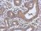 Ribosomal Protein S6 antibody, PA5-29760, Invitrogen Antibodies, Immunohistochemistry paraffin image 