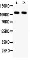 Nuclear Factor Kappa B Subunit 1 antibody, LS-C343917, Lifespan Biosciences, Western Blot image 