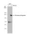 Phosphatidylinositol-4,5-Bisphosphate 3-Kinase Catalytic Subunit Gamma antibody, NBP2-15071, Novus Biologicals, Western Blot image 