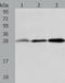 AlkB Homolog 2, Alpha-Ketoglutarate Dependent Dioxygenase antibody, TA321251, Origene, Western Blot image 