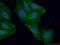 Troponin C1, Slow Skeletal And Cardiac Type antibody, 13504-1-AP, Proteintech Group, Immunofluorescence image 