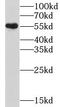 Cholinergic Receptor Nicotinic Beta 4 Subunit antibody, FNab01684, FineTest, Western Blot image 