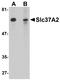 Solute Carrier Family 37 Member 2 antibody, A11124, Boster Biological Technology, Western Blot image 