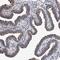 EF-Hand Calcium Binding Domain 7 antibody, HPA029611, Atlas Antibodies, Immunohistochemistry paraffin image 