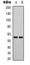 TAG-72 antibody, orb388041, Biorbyt, Western Blot image 