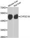 Cytochrome P450 Family 2 Subfamily C Member 18 antibody, A7431, ABclonal Technology, Western Blot image 