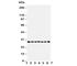 Kallikrein-11 antibody, R30714, NSJ Bioreagents, Western Blot image 