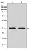 RAB4A, Member RAS Oncogene Family antibody, M04643-1, Boster Biological Technology, Western Blot image 