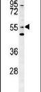 Lectin, Mannose Binding 1 Like antibody, PA5-25618, Invitrogen Antibodies, Western Blot image 