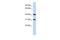 Protein FAM46D antibody, GTX45632, GeneTex, Western Blot image 