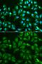 Galectin 3 antibody, GTX55633, GeneTex, Immunocytochemistry image 