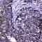 Cyclin Dependent Kinase 6 antibody, PA5-79027, Invitrogen Antibodies, Immunohistochemistry frozen image 