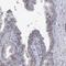 NADH:Ubiquinone Oxidoreductase Subunit C2 antibody, PA5-58572, Invitrogen Antibodies, Immunohistochemistry frozen image 
