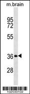 Dickkopf WNT Signaling Pathway Inhibitor 2 antibody, 58-167, ProSci, Western Blot image 