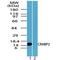 Cellular Retinoic Acid Binding Protein 2 antibody, PA5-23213, Invitrogen Antibodies, Western Blot image 