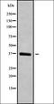 ATP Binding Cassette Subfamily A Member 5 antibody, orb338042, Biorbyt, Western Blot image 