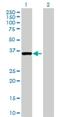 Protein Kinase Domain Containing, Cytoplasmic antibody, H00091461-B01P, Novus Biologicals, Western Blot image 