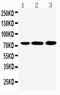 Glucuronidase Beta antibody, PA1916, Boster Biological Technology, Western Blot image 