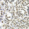 Interferon Regulatory Factor 2 antibody, LS-C346066, Lifespan Biosciences, Immunohistochemistry paraffin image 