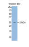 Aggrecan antibody, LS-C299896, Lifespan Biosciences, Western Blot image 