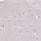 Kelch Like Family Member 24 antibody, NBP2-37705, Novus Biologicals, Immunohistochemistry frozen image 
