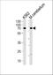 EPM2A Interacting Protein 1 antibody, A12427, Boster Biological Technology, Western Blot image 