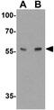 Arylsulfatase B antibody, GTX31552, GeneTex, Western Blot image 