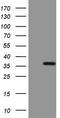 ERCC Excision Repair 8, CSA Ubiquitin Ligase Complex Subunit antibody, LS-C794402, Lifespan Biosciences, Western Blot image 