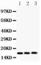 Fragile Histidine Triad Diadenosine Triphosphatase antibody, PB9181, Boster Biological Technology, Western Blot image 