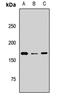 Bromodomain Adjacent To Zinc Finger Domain 1B antibody, LS-C668544, Lifespan Biosciences, Western Blot image 