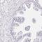 GLIPR1 Like 1 antibody, NBP1-82722, Novus Biologicals, Immunohistochemistry paraffin image 