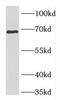 Decapping MRNA 1B antibody, FNab02270, FineTest, Western Blot image 