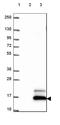 Lymphocyte antigen 6D antibody, HPA064317, Atlas Antibodies, Western Blot image 