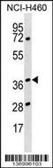 Heterogeneous Nuclear Ribonucleoprotein H3 antibody, 58-931, ProSci, Western Blot image 