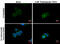 Sequestosome 1 antibody, GTX629890, GeneTex, Immunofluorescence image 