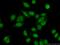 Smad Nuclear Interacting Protein 1 antibody, 14950-1-AP, Proteintech Group, Immunofluorescence image 