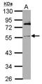 IPK6 antibody, orb69913, Biorbyt, Western Blot image 