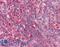 Baculoviral IAP Repeat Containing 3 antibody, LS-B4869, Lifespan Biosciences, Immunohistochemistry paraffin image 