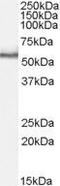 Serine/threonine-protein kinase PINK1, mitochondrial antibody, GTX88986, GeneTex, Western Blot image 